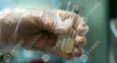 国产精子窝 在线视频,揭秘精子采集与储存的神秘世界